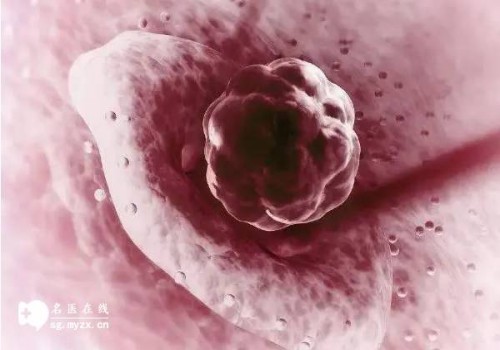 二维彩超可以检查出胎儿出现畸形吗-了解清楚之后提前准备好